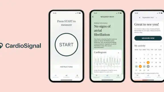 CardioSignal