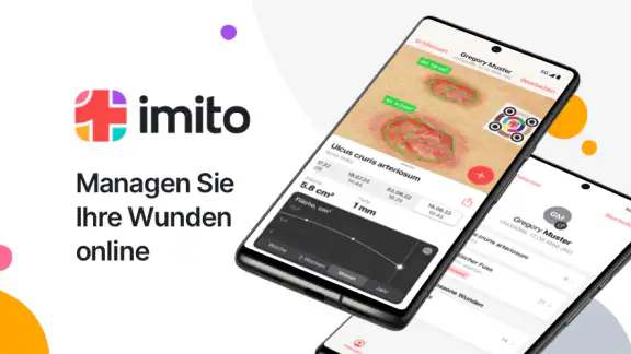 imitoWound - Wunddokumentation
