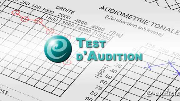 Test d'Audition