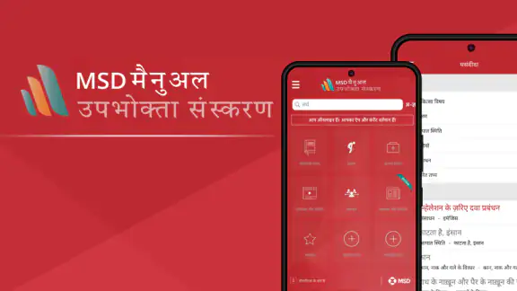 MSD मैनुअल उपभोक्ता संस्करण