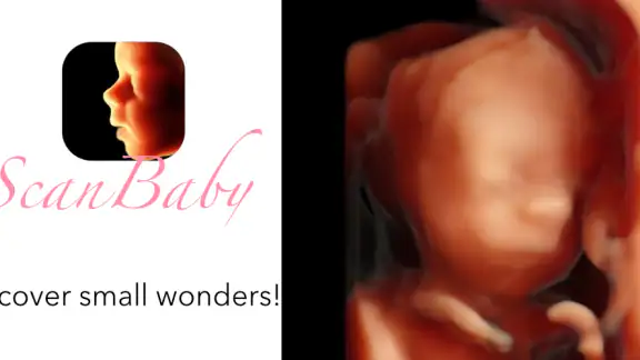 ScanBaby learn baby ultrasound