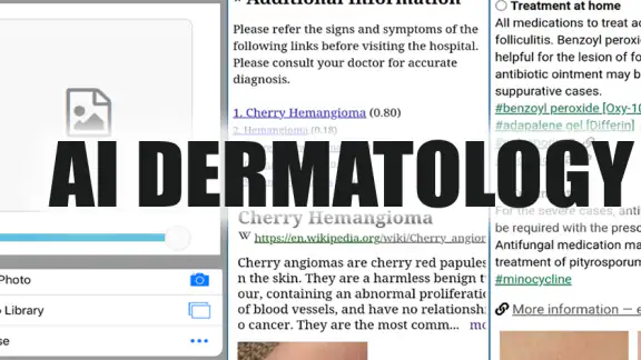 Model Dermatol – 皮膚疾患
