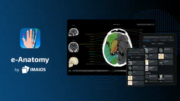IMAIOS e-Anatomy