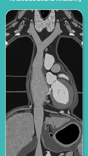 Anatomy Learning - 3D Anatomy screenshot