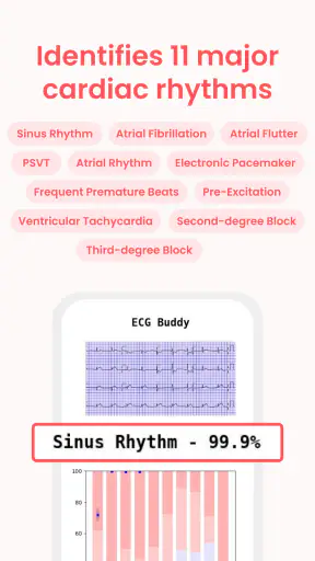 ECG Buddy | ECG Analysis AI screenshot