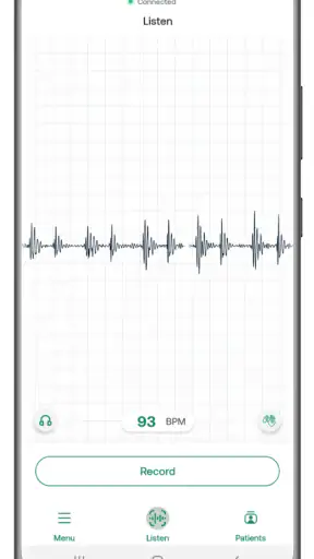 Eko: Digitale Stethoskope screenshot