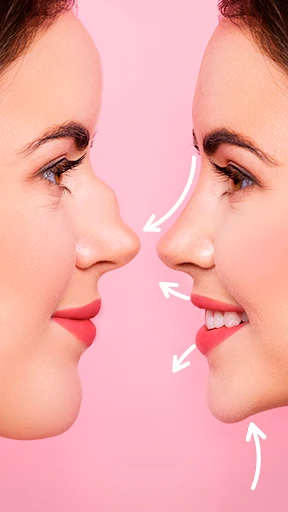 Rhinoplasty App: Nose Editor screenshot
