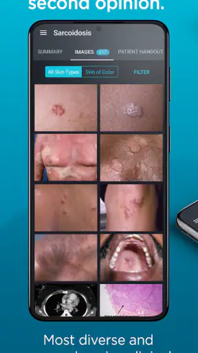 VisualDx screenshot