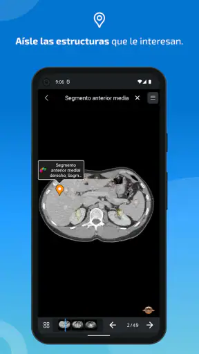 IMAIOS e-Anatomy screenshot