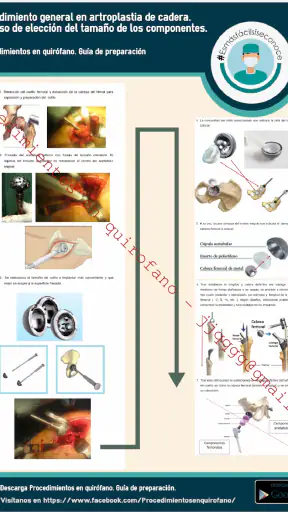 Procedimientos en quirófano screenshot