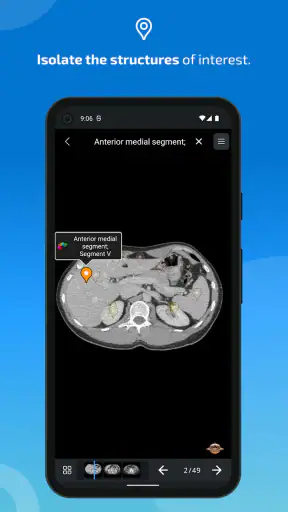 IMAIOS e-Anatomy screenshot