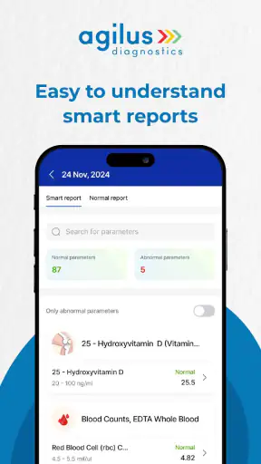 Agilus Diagnostics: ब्लड टेस्ट screenshot