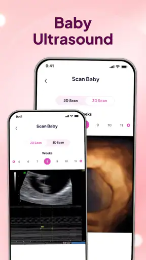 Baby Track - Pregnancy Journey screenshot