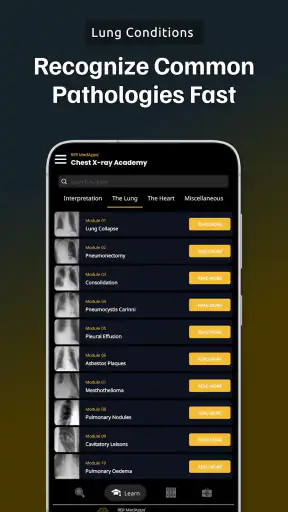 Chest Xray Academy | CXR Cases screenshot