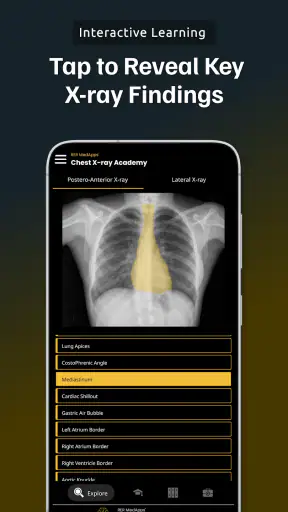 Chest Xray Academy | CXR Cases screenshot