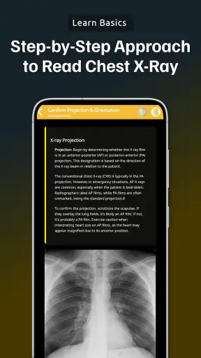 Chest Xray Academy | CXR Cases screenshot