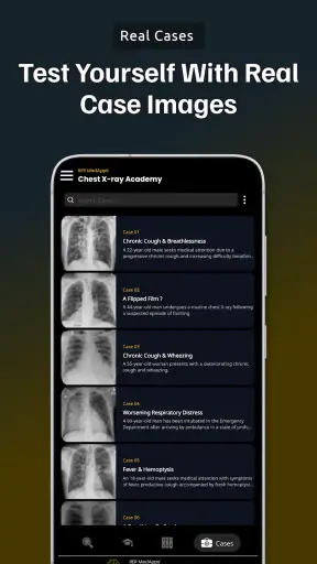 Chest Xray Academy | CXR Cases screenshot