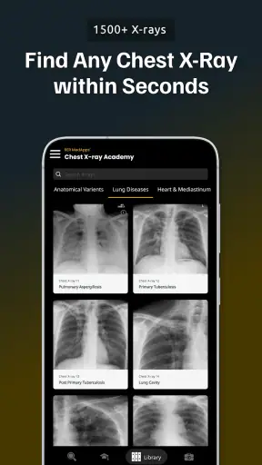 Chest Xray Academy | CXR Cases screenshot