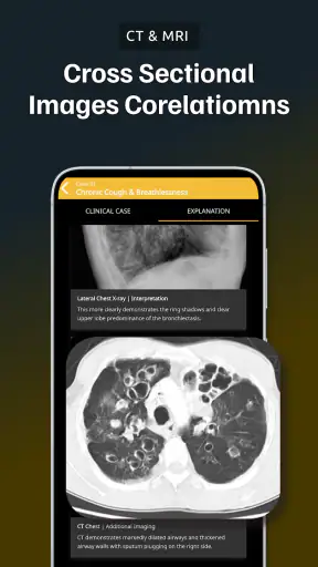 Chest Xray Academy | CXR Cases screenshot