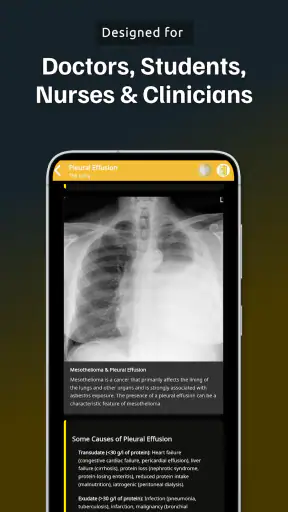 Chest Xray Academy | CXR Cases screenshot