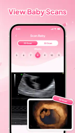 Due Date & Baby Tracker screenshot