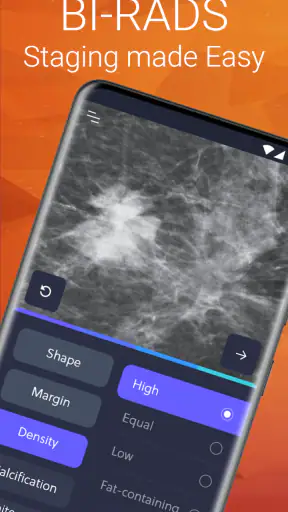 Mammography Assistant screenshot