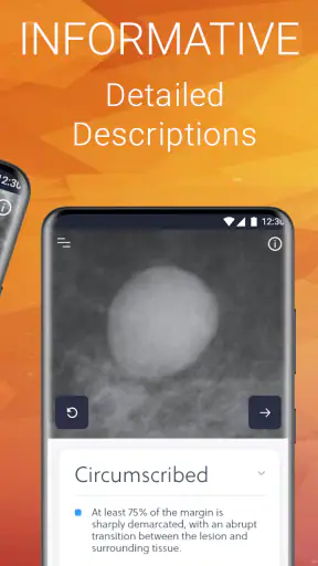 Mammography Assistant screenshot