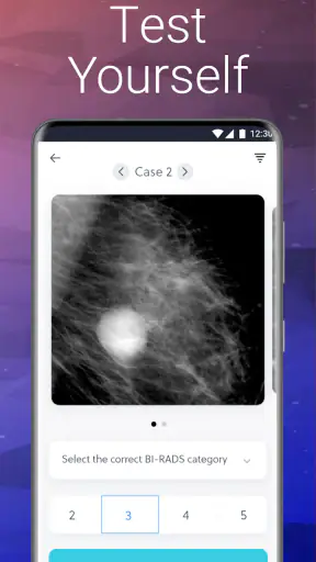 Mammography Assistant screenshot