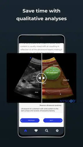 Point of Care Ultrasound screenshot
