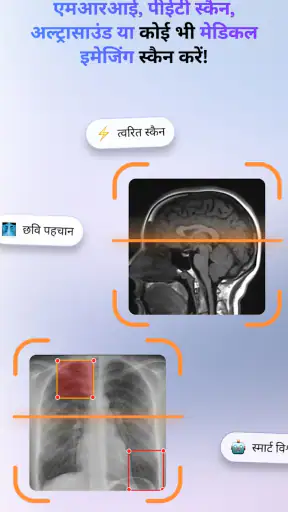 डॉक्टर & रेडियोलॉजी-MedScan AI screenshot