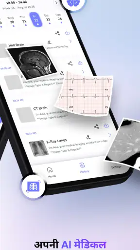 डॉक्टर & रेडियोलॉजी-MedScan AI screenshot