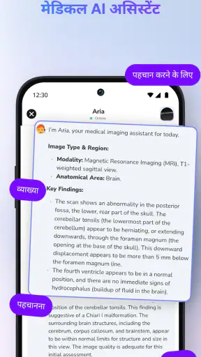 डॉक्टर & रेडियोलॉजी-MedScan AI screenshot
