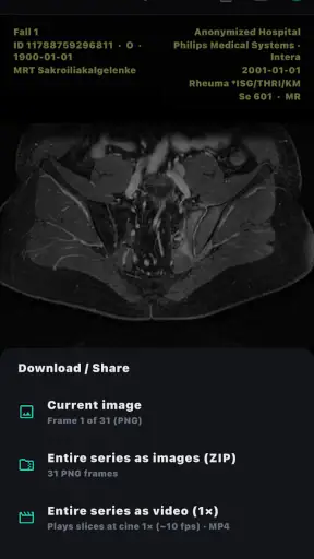 DICOM Viewer screenshot