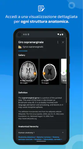 IMAIOS e-Anatomy screenshot