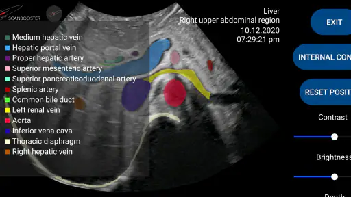 Scanbooster Ultrasound Sim screenshot