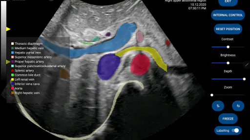 Scanbooster Ultrasound Sim screenshot