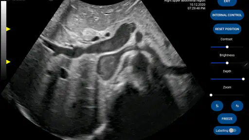 Scanbooster Ultrasound Sim screenshot