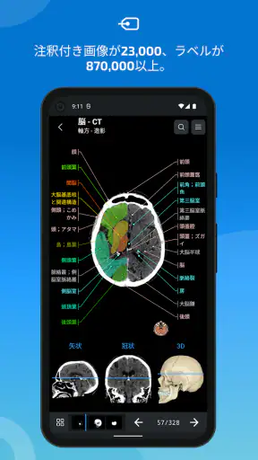 IMAIOS e-Anatomy screenshot