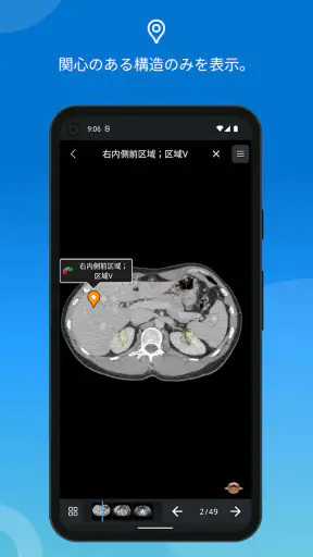 IMAIOS e-Anatomy screenshot