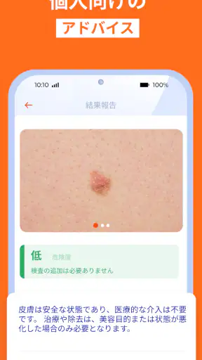 AI肌診断・肌スキャン: 健康・美容・UV指数・紫外線 screenshot