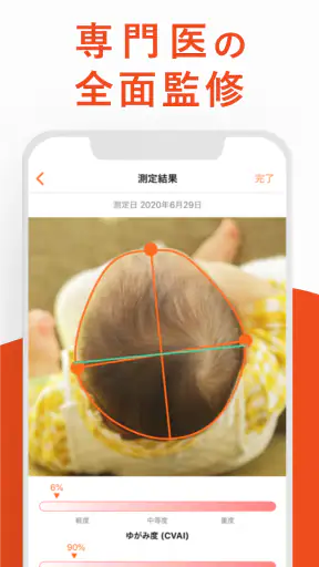 赤ちゃんの頭のかたち測定 screenshot