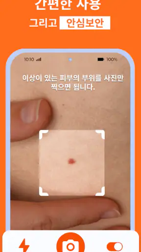 AI 피부과 피부 스캐너: 건강상태 자가진단 및 미용 screenshot