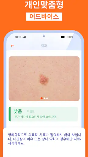 AI 피부과 피부 스캐너: 건강상태 자가진단 및 미용 screenshot
