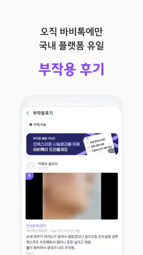 바비톡 - 900만이 선택한 대표 성형/시술 플랫폼 screenshot