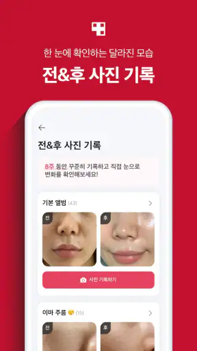 에이지알 - 메디큐브 디지털클리닉 AGE-R screenshot