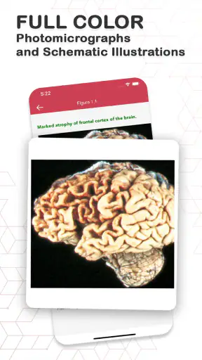 Board Review Series-Pathology screenshot