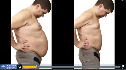 Plastic Surgery Simulator screenshot