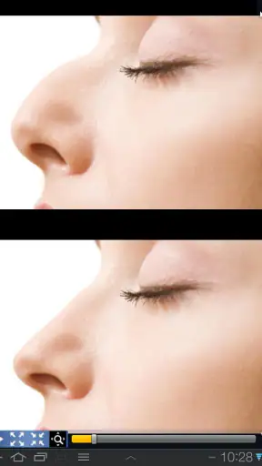 Plastic Surgery Simulator screenshot