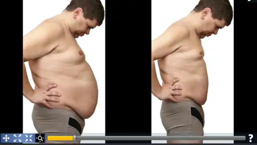 Plastic Surgery Simulator screenshot