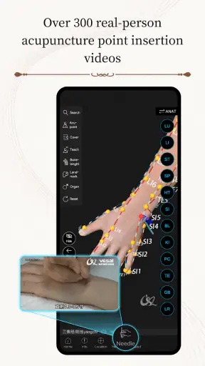 Acupuncture Master screenshot